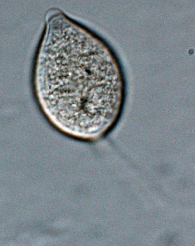 Phytophthora kernoviae nbsp;(selected specimen P10957) asexual phase:nbsp;sporangiumnbsp;with long pedicelnbsp;formed on V8 agar flooded with soil extract; photonbsp;by Gloria Abad, USDA-APHIS-PPQ.
