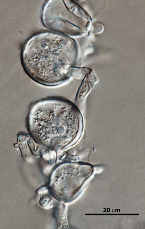 Phytophthora cinnamomi nbsp;selected specimen P6490 asexual phase: different shapes of persistent sporangia and typical coralloid mycelia;nbsp;photo by Gloria Abad, USDA-APHIS-PPQ.