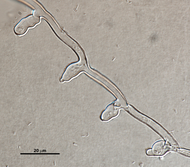 Phytophthora cinnamomi nbsp;selected specimen P6490 asexual phase: coralloid mycelia; photo by Gloria Abad, USDA-APHIS-PPQ.