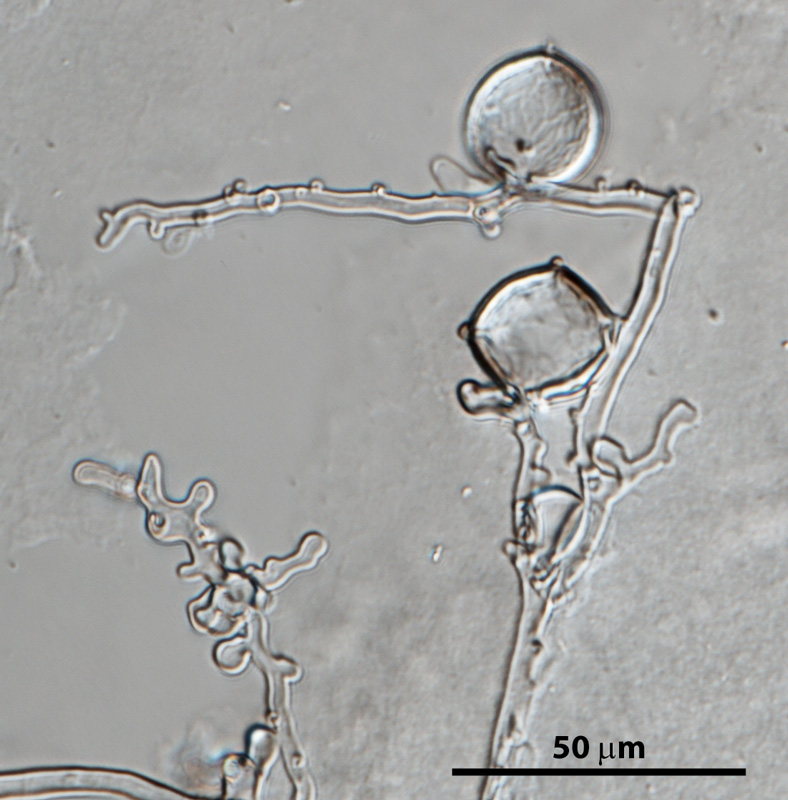 Phytophthora cinnamomi nbsp;selected specimen P6490 asexual phase: hyphal swellings and typical coralloid mycelia; photo by Gloria Abad, USDA-APHIS-PPQ.