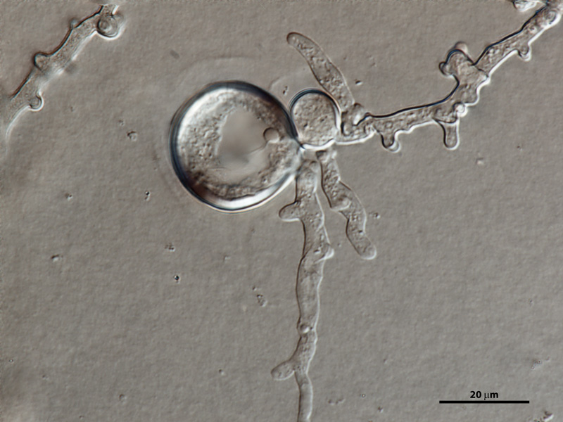 Phytophthora cinnamomi nbsp;selected specimen P6490 asexual phase: hyphal swellings and typical coralloid mycelia; photo by Gloria Abad, USDA-APHIS-PPQ.