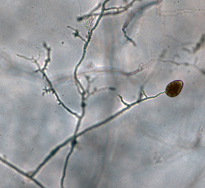 Phytophthora cinnamomi nbsp;selected specimen P6490 asexual phase: nonpapillate sporangia borne on simple sympodial sporangiophore; photo by Gloria Abad, USDA-APHIS-PPQ.
