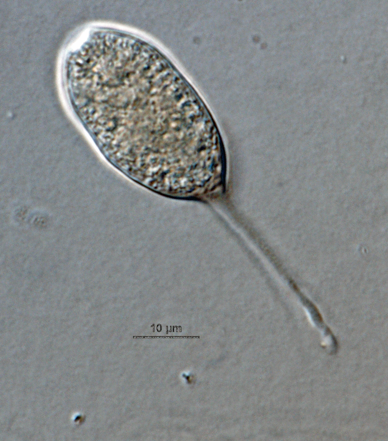 Phytophthora hibernalis (CPHST BL 41G) asexual phase: semipapillate caducous sporangium, with medium length pedicel; photo by Gloria Abad, USDA-APHIS-PPQ.