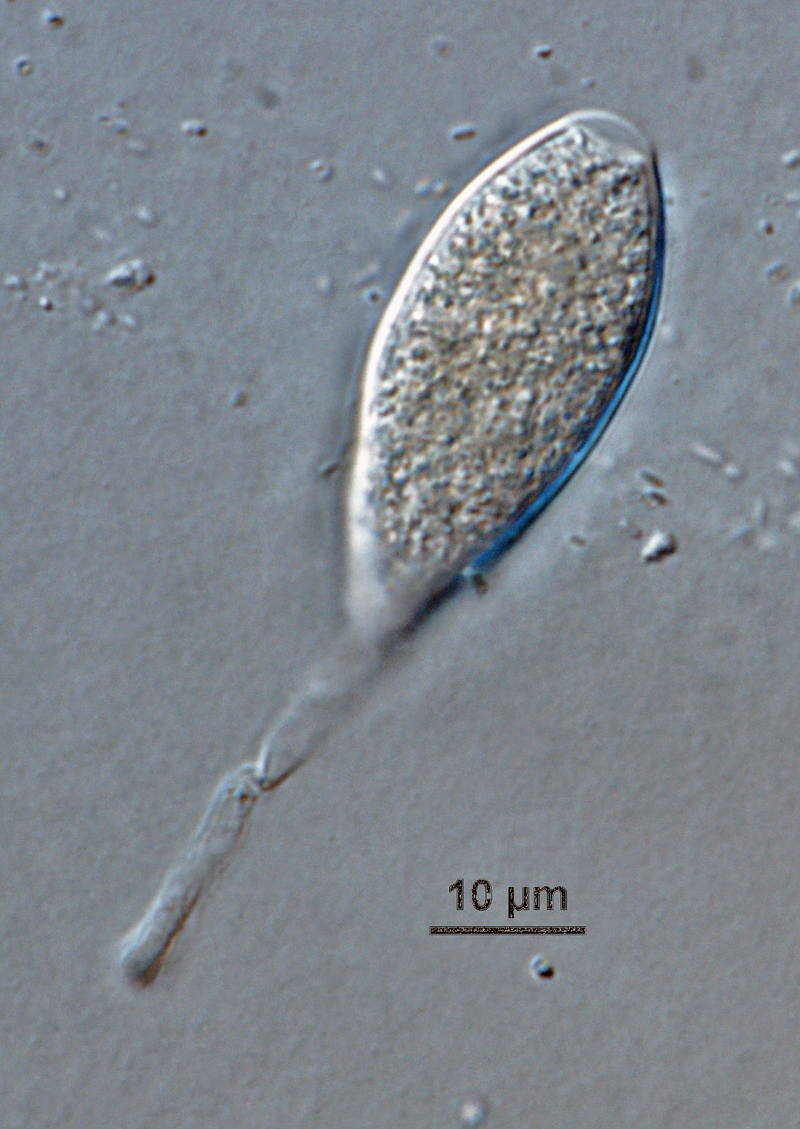 Phytophthora hibernalis (CPHST BL 41G) asexual phase: semipapillate caducous sporangium, with medium length pedicel; photo by Gloria Abad, USDA-APHIS-PPQ.