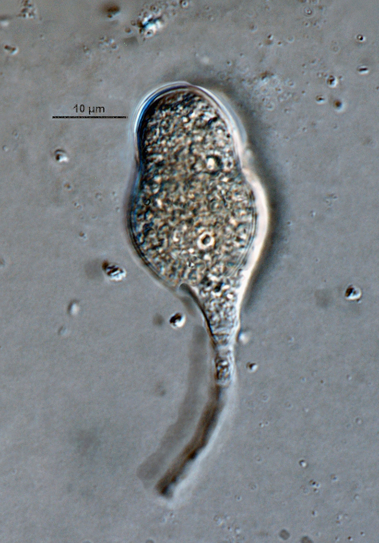 Phytophthora hibernalis (CPHST BL 41G) asexual phase: semipapillate caducous sporangium, with medium length pedicel; photo by Gloria Abad, USDA-APHIS-PPQ.