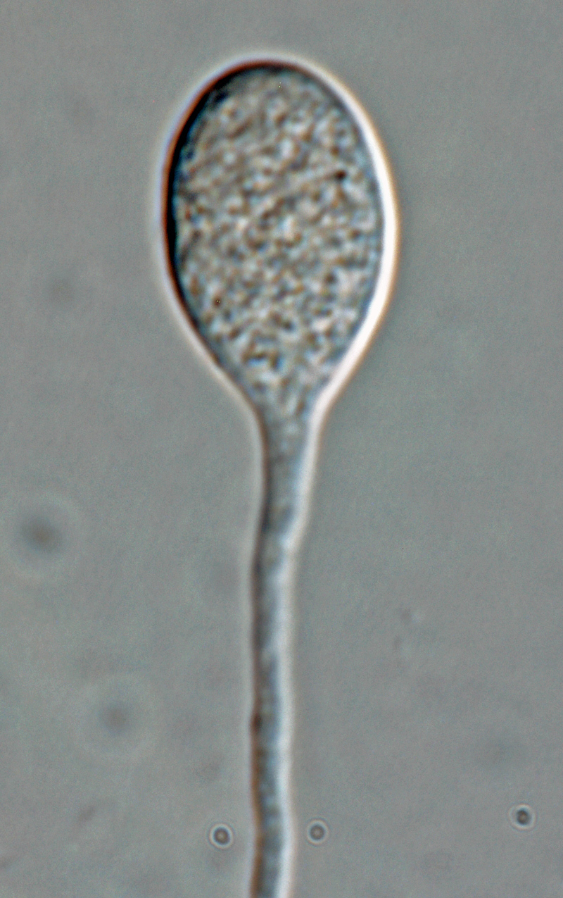 Phytophthora kernoviae nbsp;(selected specimen P10957) asexual phase: sporangiumnbsp;produced in unbranched sporangiophore; photonbsp;by Gloria Abad, USDA-APHIS-PPQ.