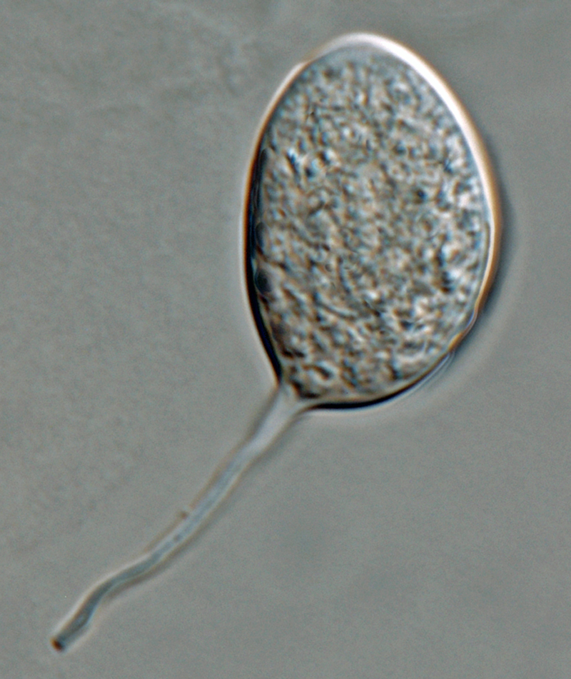 Phytophthora kernoviae nbsp;(selected specimen P10957) asexual phase:nbsp;sporangiumnbsp;with long pedicelnbsp;formed on V8 agar flooded with soil extract; photonbsp;by Gloria Abad, USDA-APHIS-PPQ.