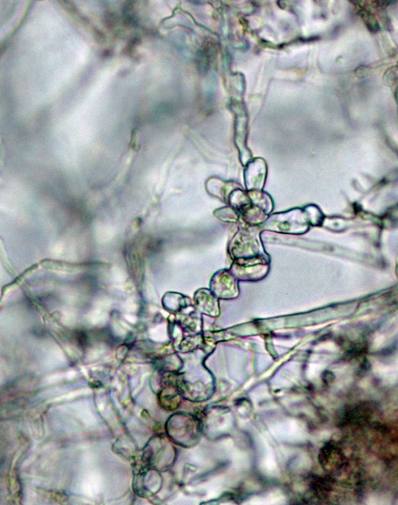 Phytophthora kernoviae nbsp;(CPHST BL 91 ex-type) asexual phase: coralloid/toruloid hyphal swellings; photonbsp;by Gloria Abad, USDA-APHIS-PPQ.