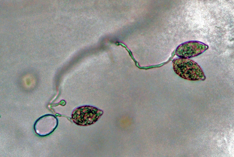 Phytophthora kernoviae nbsp;(CPHST BL 91 ex-type) asexual phase:nbsp;sporangia produced in simple sympodial sporangiophores; photonbsp;by Gloria Abad, USDA-APHIS-PPQ.