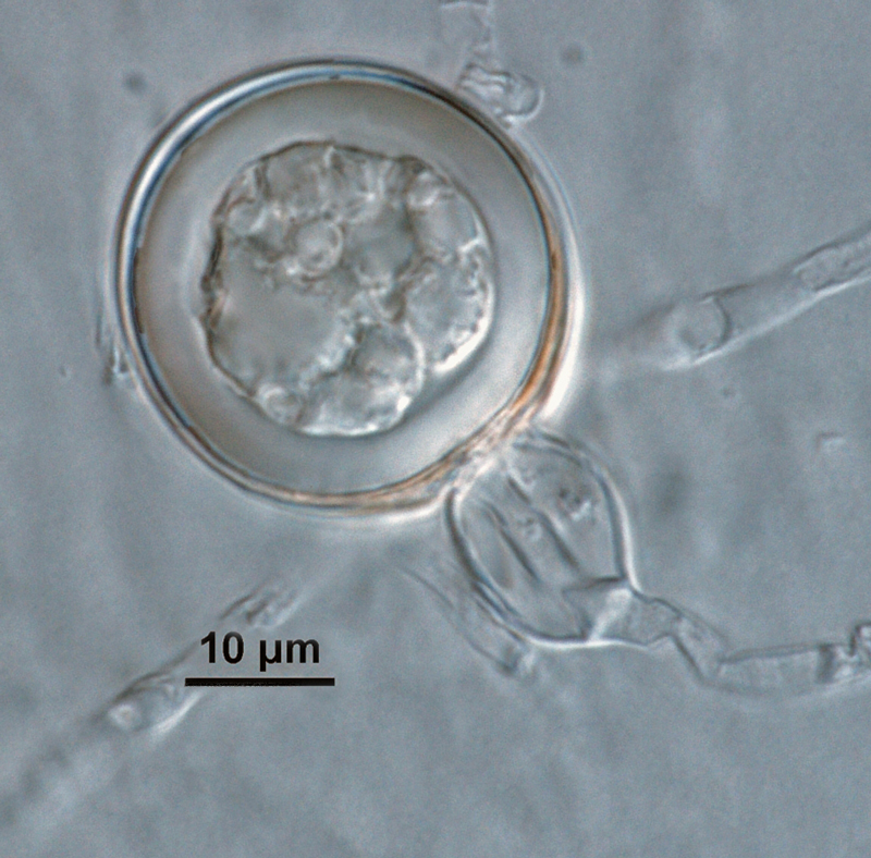 Phytophthora kernoviae (CPHST BL 91, ex-type) sexual phase: smooth-walled oogonium, antheridium amphigynous,and plerotic oospore with thick walls; photo by Gloria Abad, USDA-APHIS-PPQ.