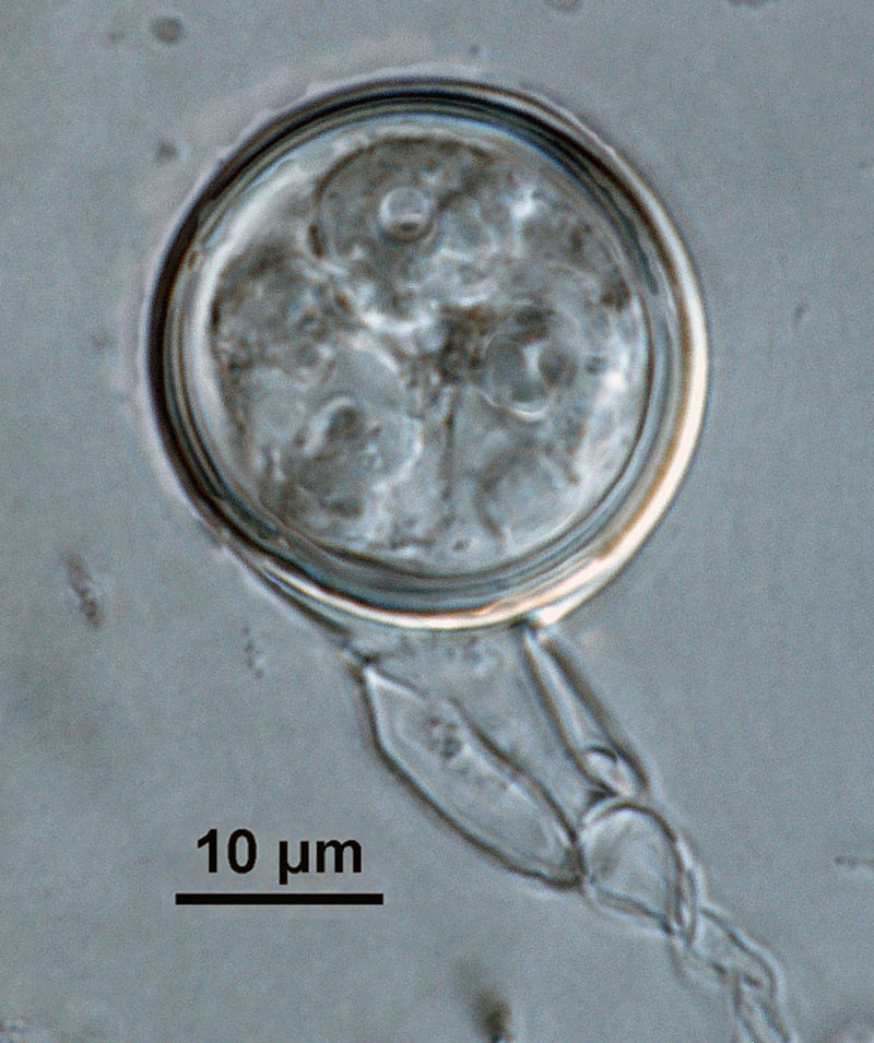 Phytophthora kernoviae nbsp;(CPHST BL 91, ex-type) sexual phase: smooth-walled oogonium with tapered bases, antheridium amphigynous,and plerotic oospore with thick walls; photo by Gloria Abad, USDA-APHIS-PPQ.