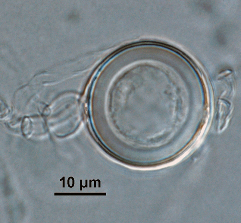 Phytophthora kernoviae nbsp;(CPHST BL 91, ex-type) sexual phase: smooth-walled oogonium, antheridium amphigynous,and plerotic oospore with thick walls; photo by Gloria Abad, USDA-APHIS-PPQ.
