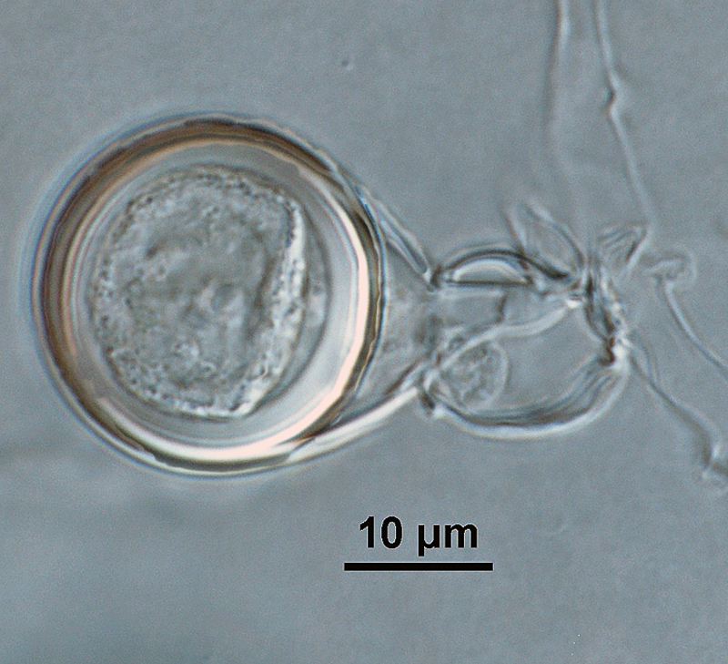 Phytophthora kernoviae nbsp;(CPHST BL 91, ex-type) sexual phase: smooth-walled oogonium with tapered bases, antheridium amphigynous,and plerotic oospore with thick walls; photo by Gloria Abad, USDA-APHIS-PPQ.
