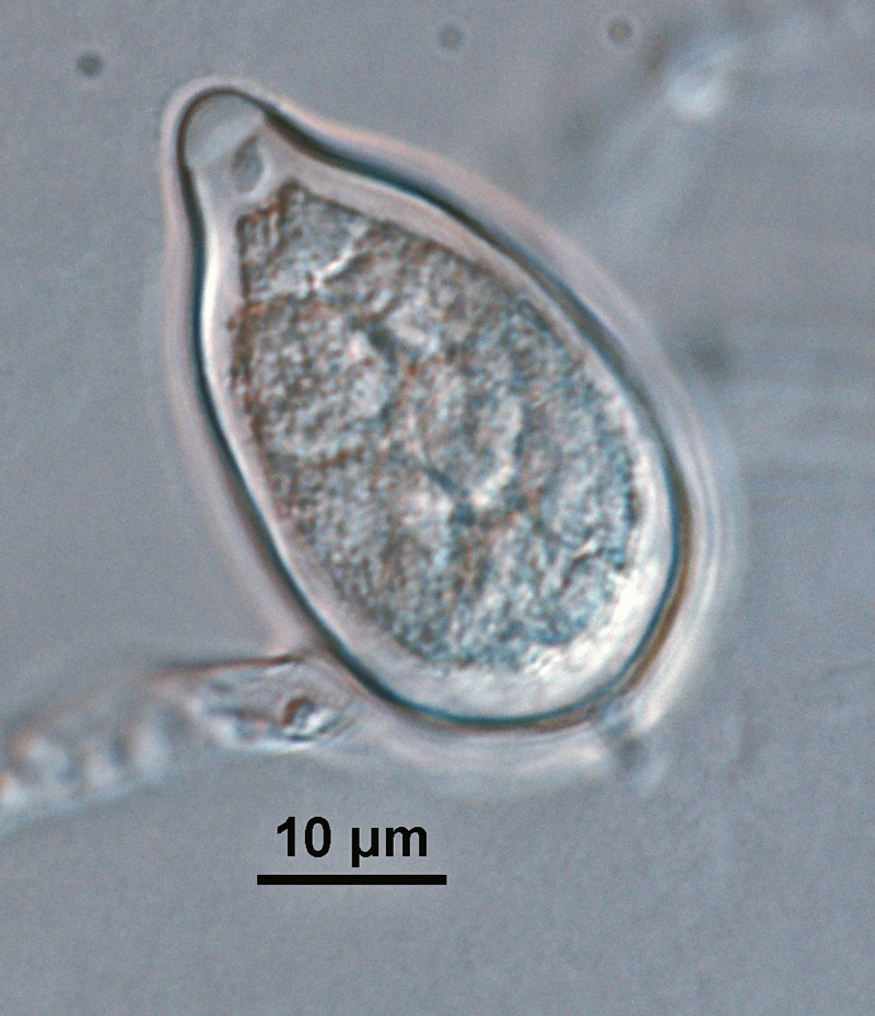 Phytophthora kernoviae nbsp;(CPHST BL 91 ex-type) asexual phase:nbsp;papillatenbsp;obpyriform sporangiumnbsp;with medium-length pedicelnbsp;formed on V8 agar flooded with soil extract; photonbsp;by Gloria Abad, USDA-APHIS-PPQ.