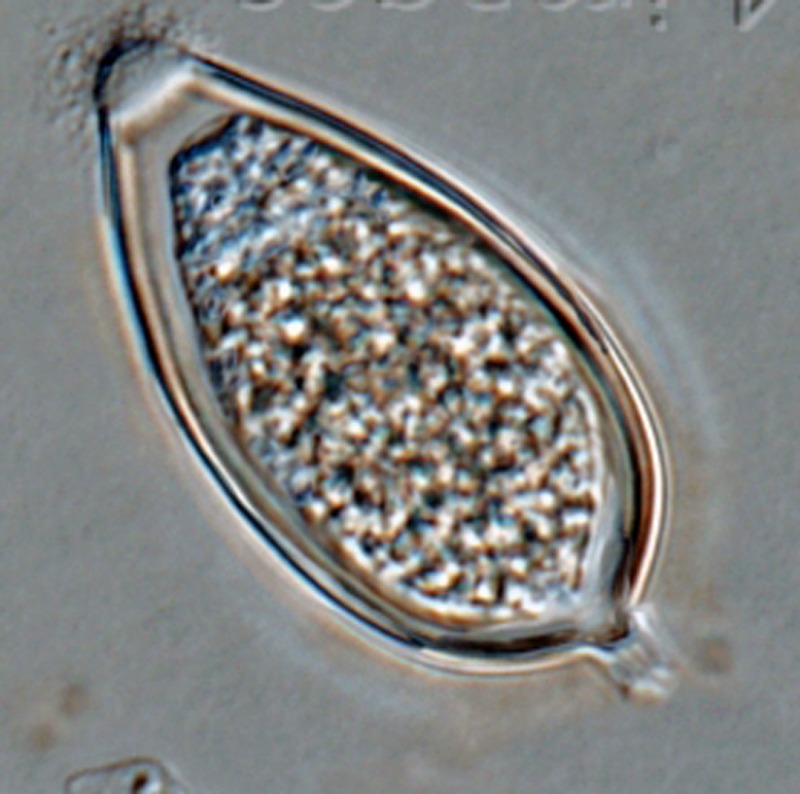 Phytophthora kernoviae nbsp;(CPHST BL 91 ex-type) asexual phase:nbsp;papillate ellipsoidnbsp;sporangiumnbsp;with medium-length pedicelnbsp;formed on V8 agar flooded with soil extract; photonbsp;by Gloria Abad, USDA-APHIS-PPQ.