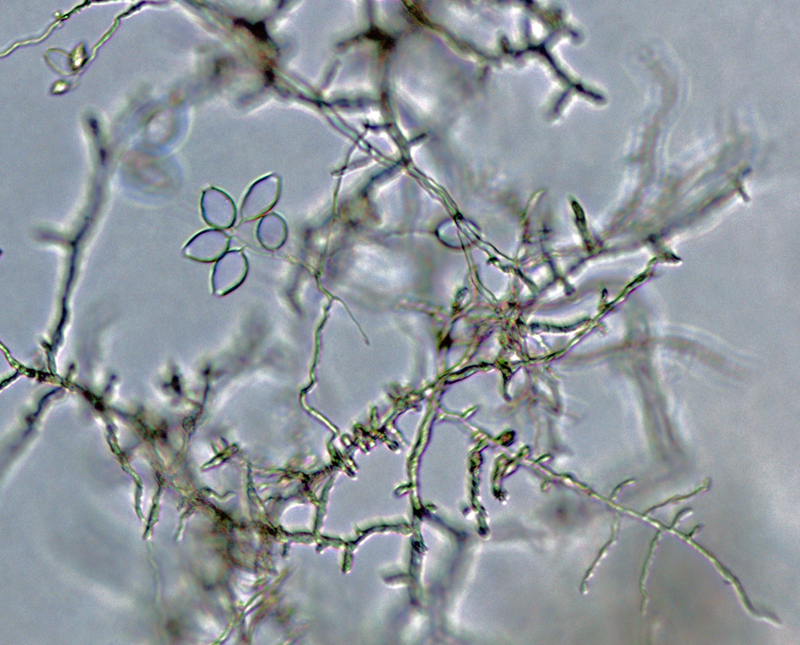 Phytophthora kernoviae nbsp;(CPHST BL 91 ex-type) asexual phase:nbsp;sporangia produced in simple sympodial sporangiophores;nbsp;photonbsp;by Gloria Abad, USDA-APHIS-PPQ.