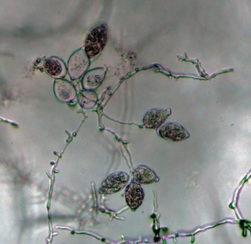 Phytophthora kernoviae nbsp;(CPHST BL 91 ex-type) asexual phase: sporangia produced in simple sympodial sporangiophores;nbsp;photonbsp;by Gloria Abad, USDA-APHIS-PPQ.