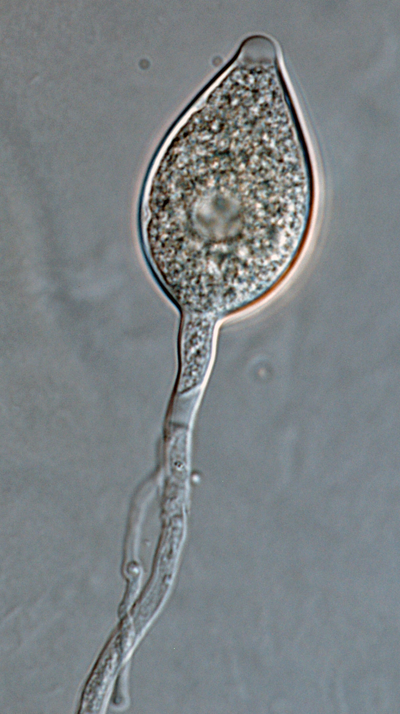 Phytophthora kernoviae (selected specimen P10681) asexual phase: sporangium borne in simple sympodial sporangiophore; photo by Gloria Abad, USDA-APHIS-PPQ.