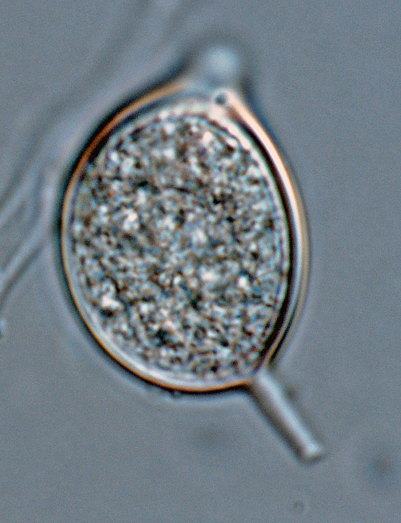 Phytophthora kernoviae nbsp;(selected specimen P10681) asexual phase: papillatenbsp;irregular shaped sporangiumnbsp;with medium-length pedicel, formed on V8 agar flooded with soil extract; photo by Gloria Abad, USDA-APHIS-PPQ.