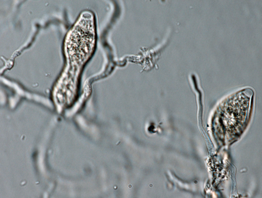 Phytophthora kernoviae (selected specimen P10681) asexual phase: papillate sporangianbsp;produced in unbranched sporangiophores; photo by Gloria Abad, USDA-APHIS-PPQ.