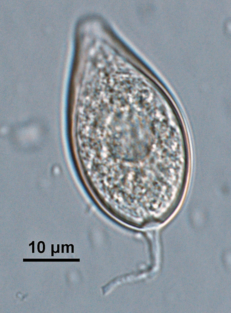 Phytophthora kernoviae (selected specimen P10681) asexual phase: papillatenbsp;ellipsoid sporangiumnbsp;with tapered topnbsp;and medium-length pedicel, formed on V8 agar flooded with soil extract; photo by Gloria Abad, USDA-APHIS-PPQ.