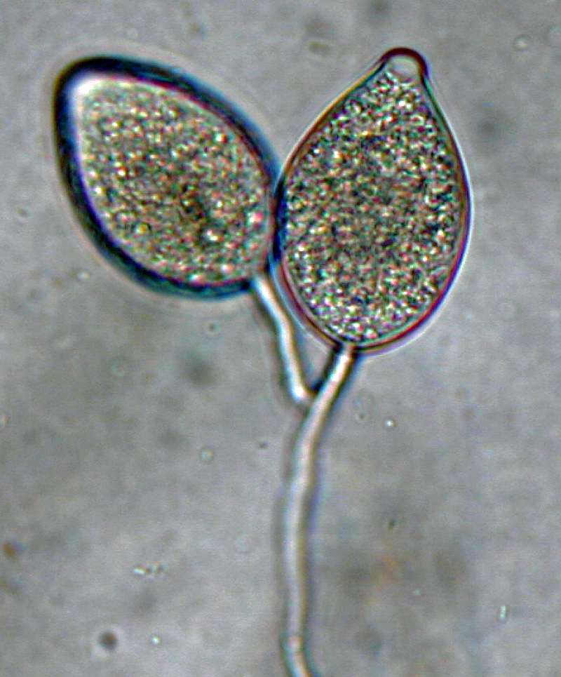 Phytophthora kernoviae nbsp;(selected specimen P10956) asexual phase: papillatenbsp;sporangia borne in simple sympodial sporangiophore; photo by Gloria Abad, USDA-APHIS-PPQ.