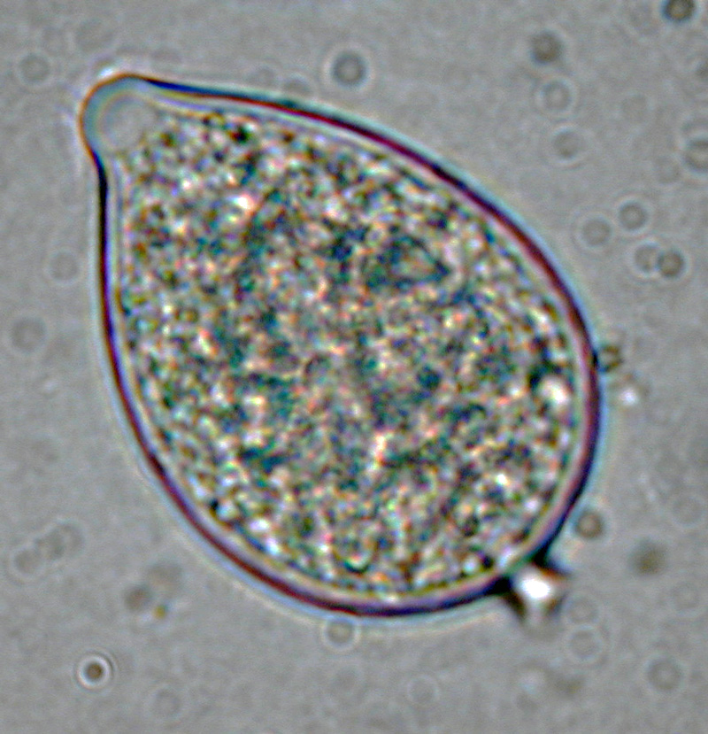 Phytophthora kernoviae (selected specimen P10956) asexual phase: papillatenbsp;sporangium with short pedicel; photo by Gloria Abad, USDA-APHIS-PPQ.