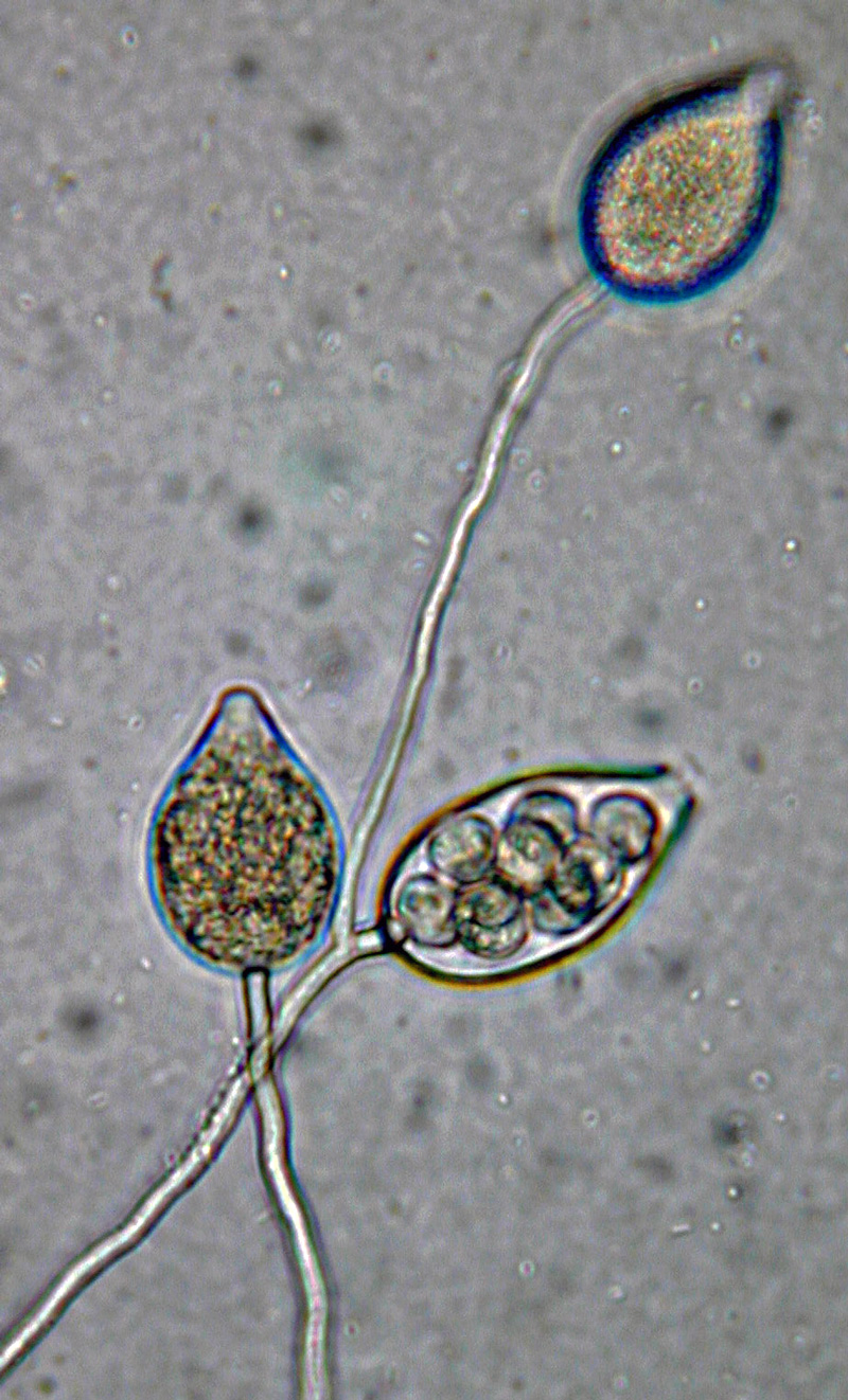 Phytophthora kernoviae nbsp;(selected specimen P10956) asexual phase: papillatenbsp;sporangia borne in simple sympodial sporangiophore; photo by Gloria Abad, USDA-APHIS-PPQ.