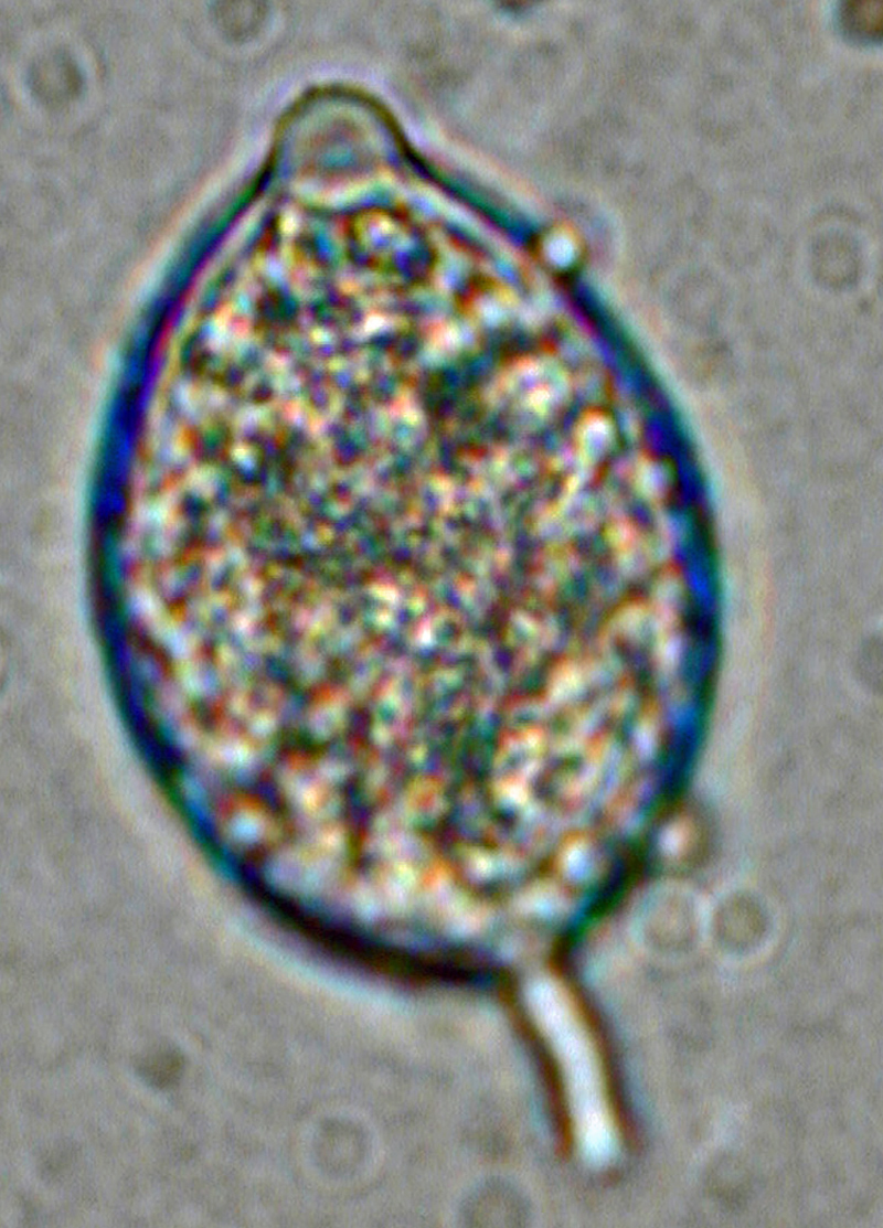 Phytophthora kernoviae (selected specimen P10956) asexual phase: papillate sporangium with short pedicel; photo by Gloria Abad, USDA-APHIS-PPQ.