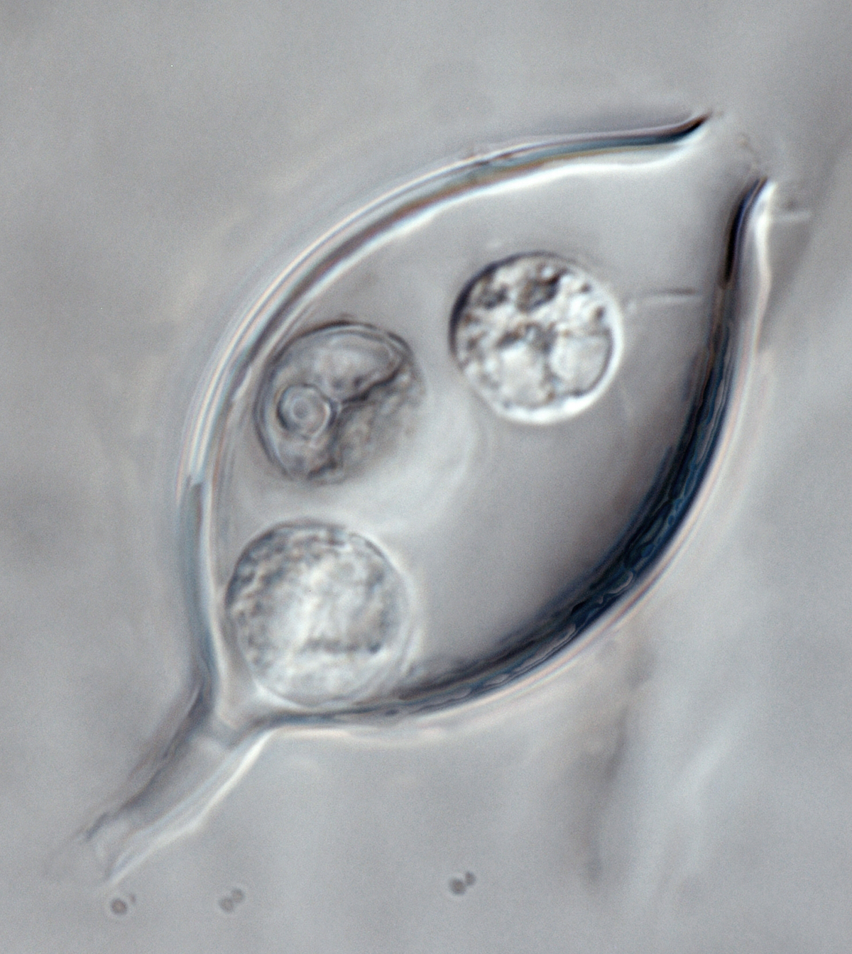 Phytophthora kernoviae nbsp;(selected specimen P10681) asexual phase: zoospores in sporangium; photonbsp;by Gloria Abad, USDA-APHIS-PPQ.