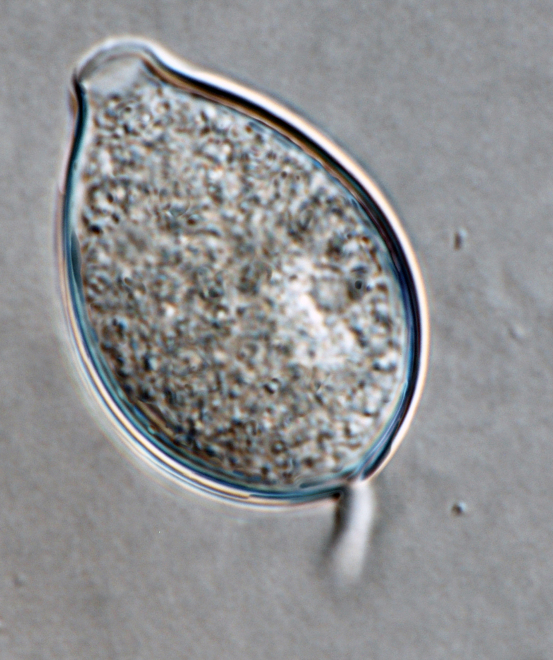Phytophthora kernoviae nbsp;(selected specimen P10957) asexual phase:nbsp;sporangiumnbsp;with long pedicelnbsp;formed on V8 agar flooded with soil extract; photonbsp;by Gloria Abad, USDA-APHIS-PPQ.