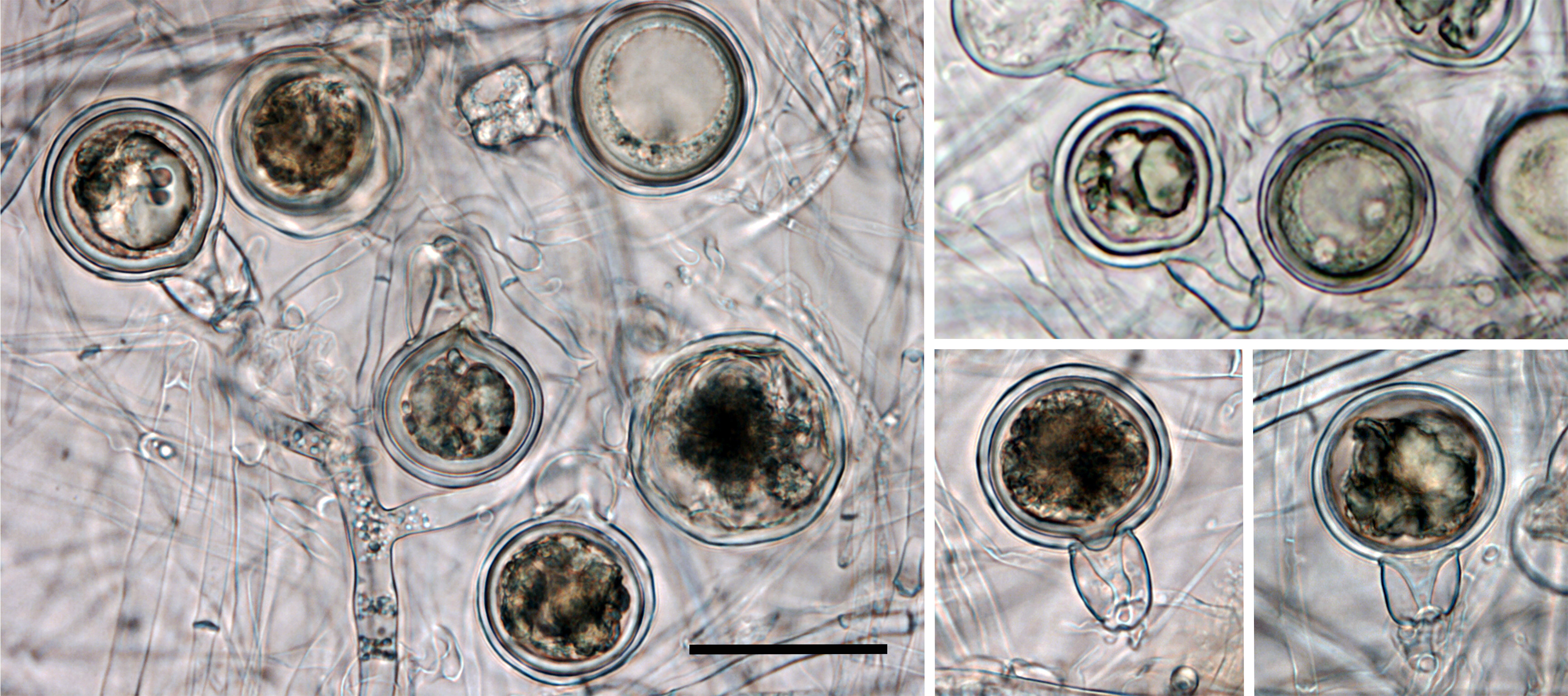Oogonia with wavy walls containing aplerotic oospores with large ooplasts which turn pale brown on maturity. Antheridia were exclusively amphigynous.nbsp; Many oospores aborted after the formation of walls. scale bar = 25micro;m