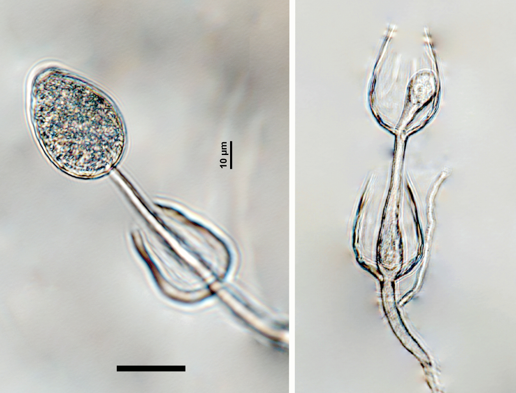 persistent, non-papillate, predominantly ovoid sporangia exhibiting internal extended proliferation; scale bar = 20micro;m