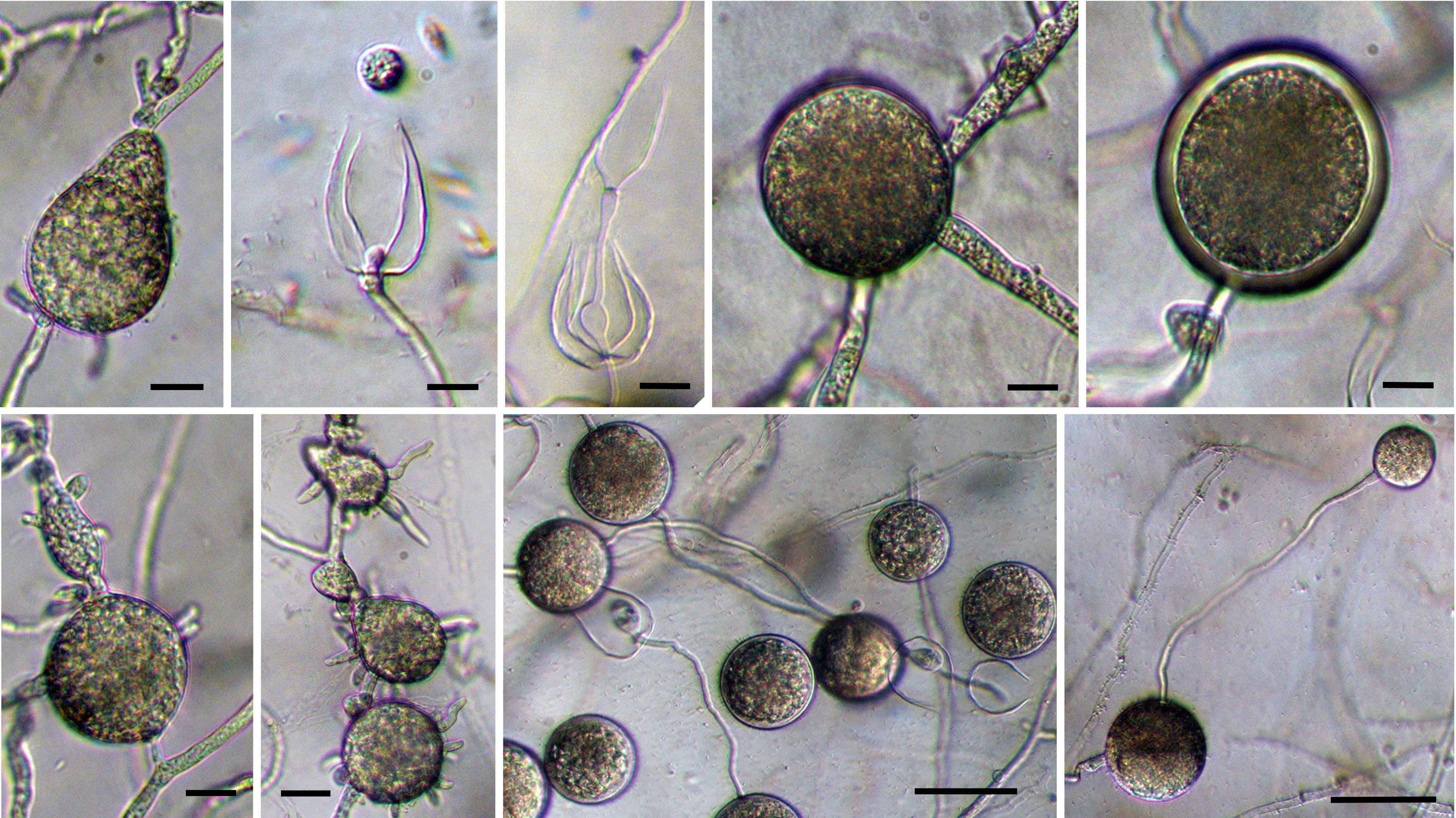 ovoid sporangia with direct germination; internal nested and extended proliferation; intercalary chlamydospore; thick-walled chlamydospore on PDA, chlamydospores germinating to produce sporangia; chlamydospores and hyphal swelling with projections; scale bar = 40micro;m