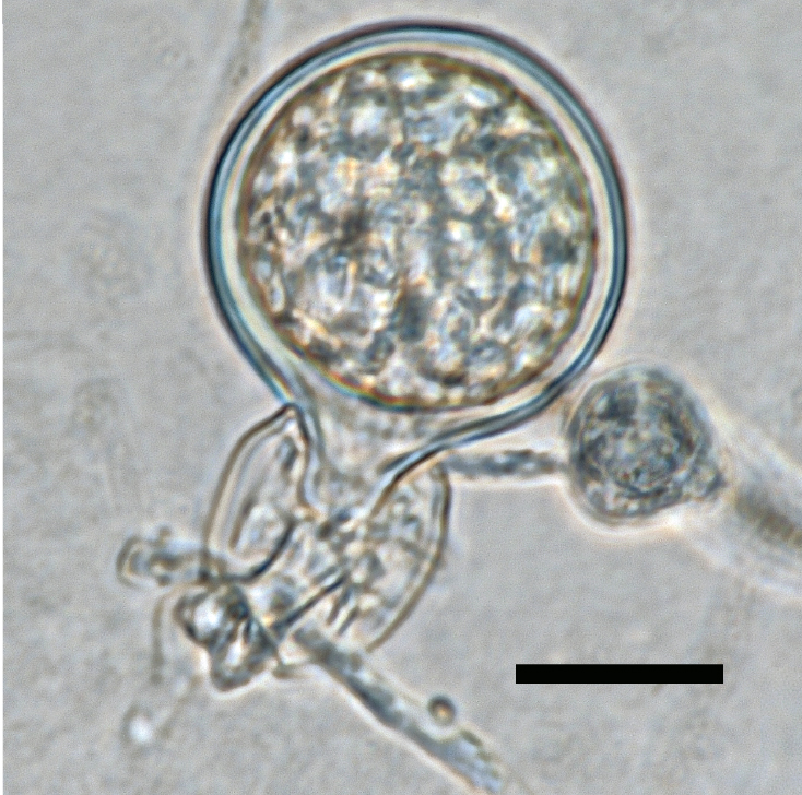oogonia with smooth walls containing plerotic oospores; antheridia were exclusively amphigynous; scale bar = 20micro;m