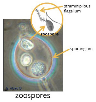Phytophthora zoospore