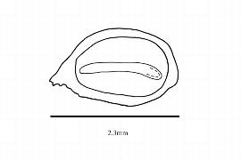   Embryo:   Monotropa uniflora ;nbsp;Illustration by K. Parker, Kirkbride et al. (2006)
