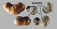 circular pod sutures