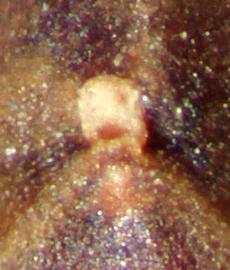  hilar notch of seed 