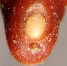  lens and hilum of seed 