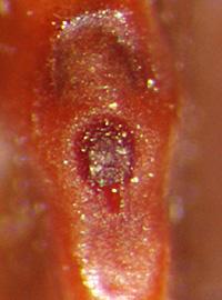  lens and hilum of seed 