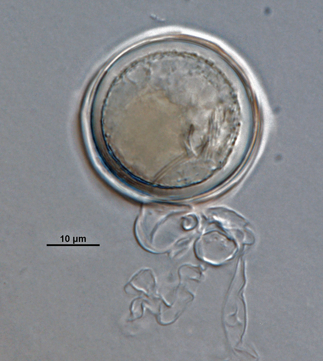 Phytophthora acerina nbsp;(ex-type CPHST BL 114) sexual phase formed on hemp seed agar. Smooth-walled oogoniumnbsp;with paragynous antheridiumnbsp;and plerotic oospore. Photonbsp;by G. Abad, USDA-APHIS-PPQ.