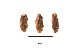  Seeds:  Adenanthe bicarpetallata ; Photo by R. Gibbons, USDA APHIS PPQ, Kirkbride et al. (2006)
