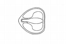   Embryo:   Hedychium gardnerianum ;nbsp;Illustration by K. Parker, Kirkbride et al. (2006) 

