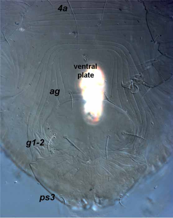            Fig. 11.   Aegyptobia alpinensis  female genital   region - note the ventral plate indicated by change in striae on cuticle (type   specimen).   