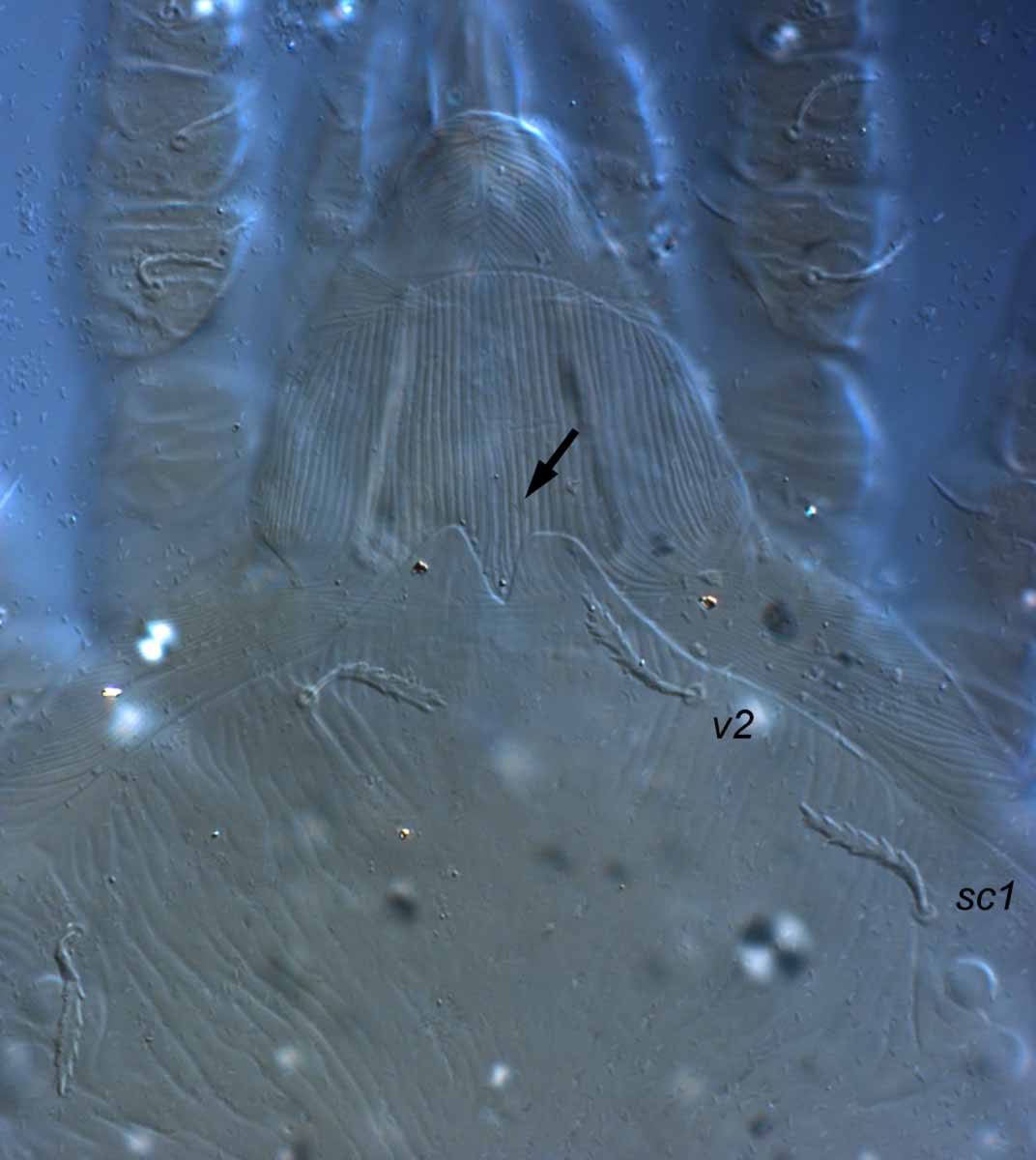            Fig. 7.   Aegyptobia alpinensis  female   prodorsum (type specimen).   