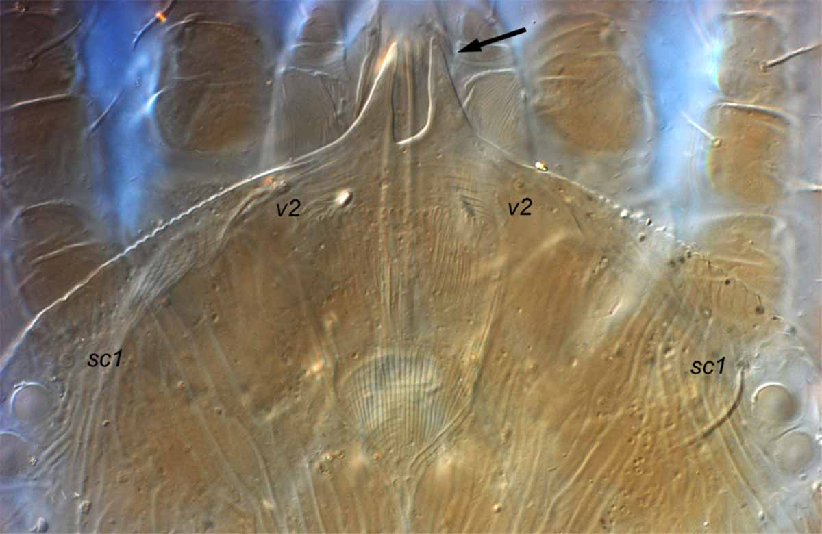            Fig. 9.   Aegyptobia pseudoleptoides  female   prodorsum (type specimen).   