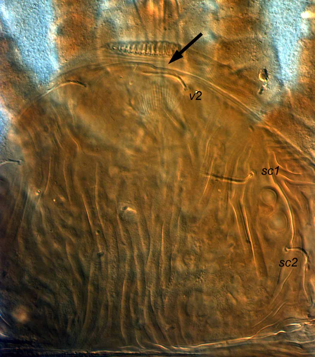            Fig. 10.   Aegyptobia torreyi  female prodorsum   (type specimen).   