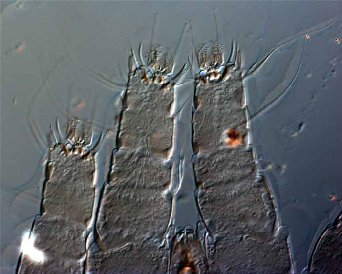            Fig. 11.   Afronychus cliffortiae  female legs   I-II, highlighting short segments (paratype).   