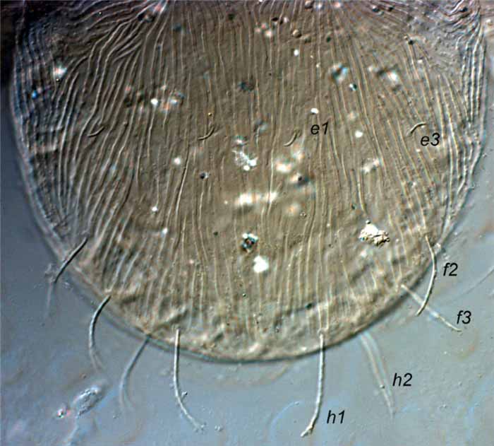            Fig. 7.   Afronychus mulibrinus  female   posterior dorsum indicating  e2  absent   (paratype).   